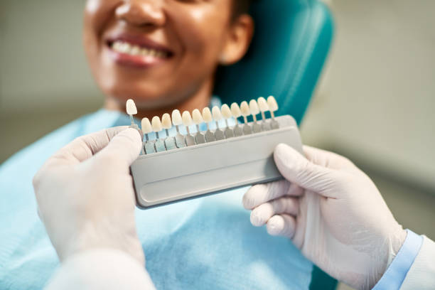 close up of smiling woman while hands hold veneer samples